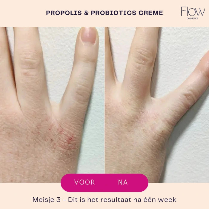 Propolis & Probiotics Rescue Cream