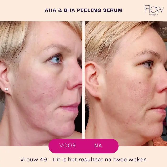 Aha & Bha Peeling Serum Mini